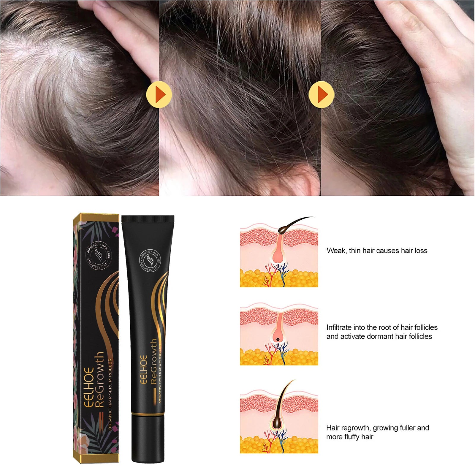 EELHOE Regrowth Hair Serum With Roller Massage Scalp Pure Natural Nourishing Roots Prevent Hair Loss Damage Thickness Hairs Care