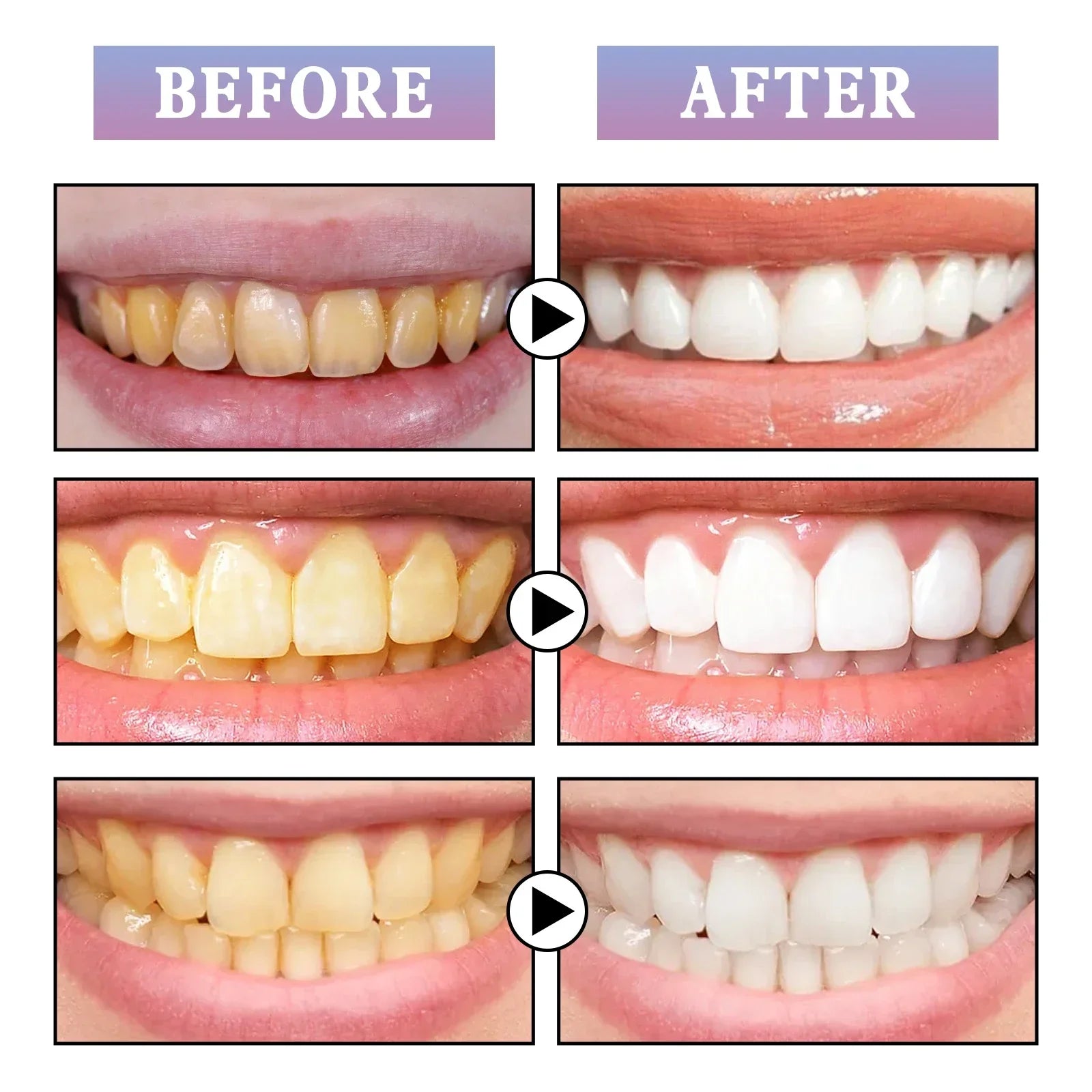 Teeth Whitening Paint Kit To Whiten Teeth,Remove Tooth Pigments and Stains,Instant Natural White Paint Mild Tooth Polish Uptight