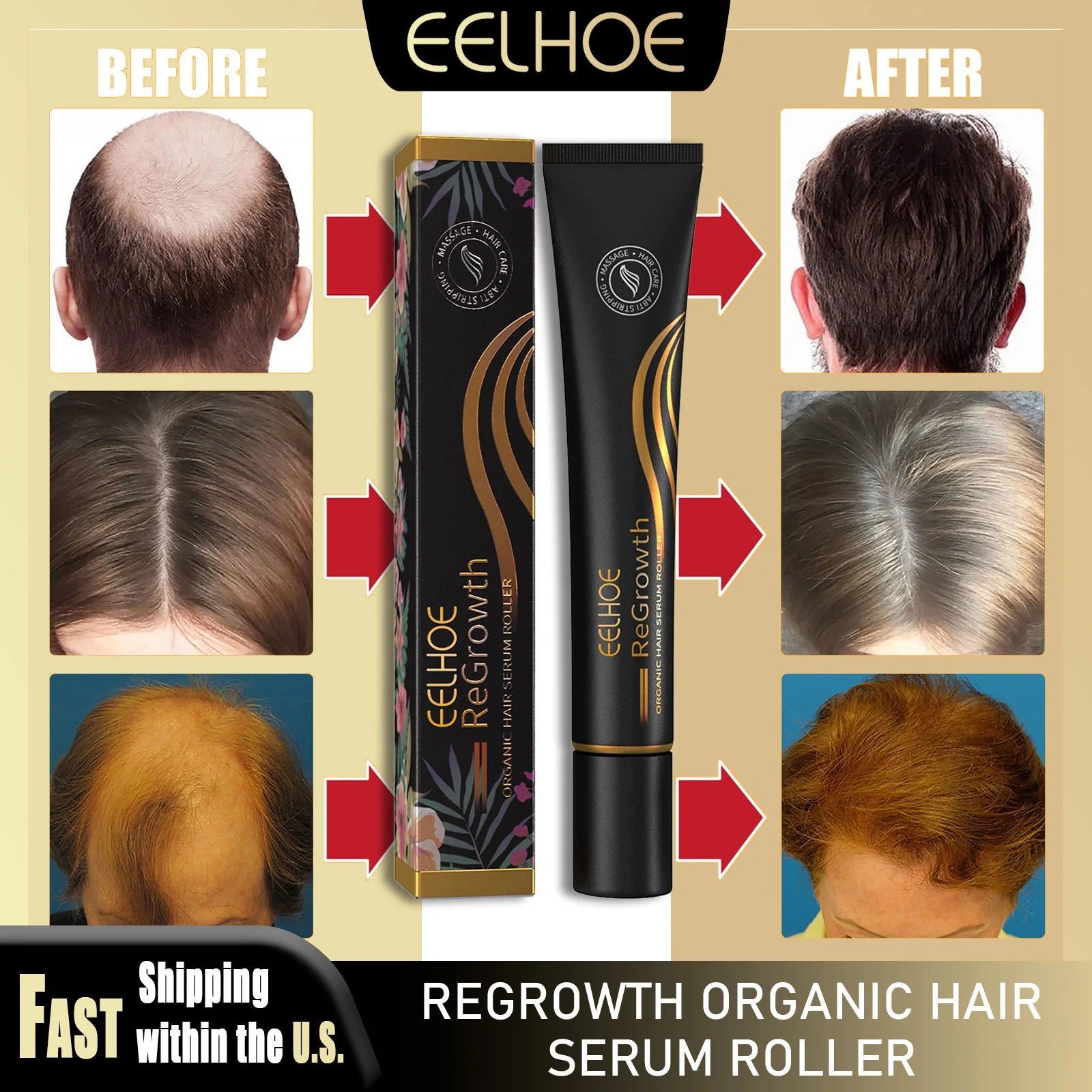 EELHOE Regrowth Hair Serum With Roller Massage Scalp Pure Natural Nourishing Roots Prevent Hair Loss Damage Thickness Hairs Care