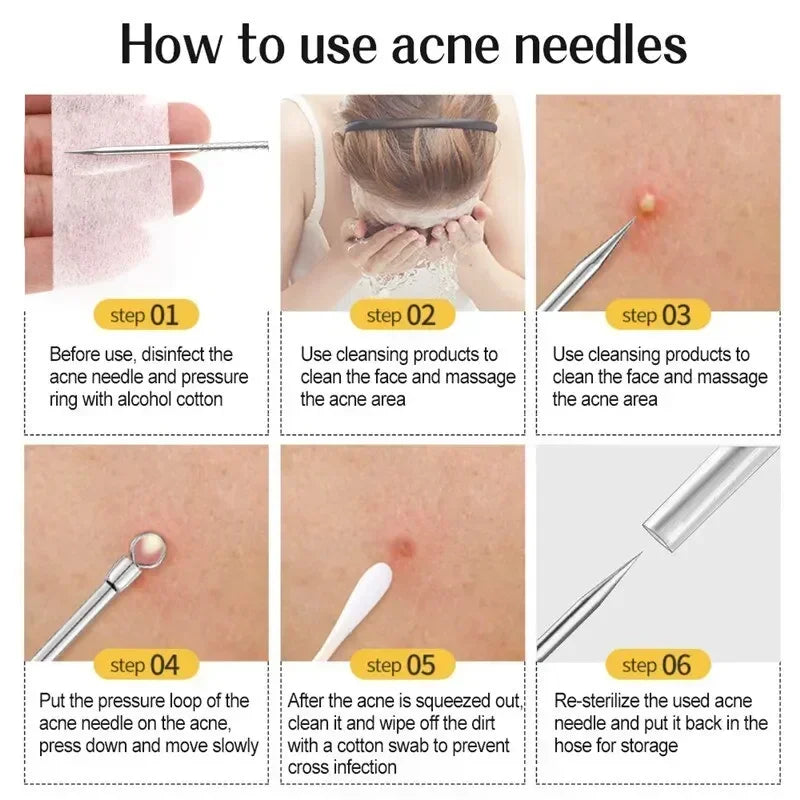 1/11Pcs Acne Pimples Blackhead Remover Clip Ultra-fine Tweezers Black Dots Blackhead Extractor Acne Needle Facial Cleaner Skin