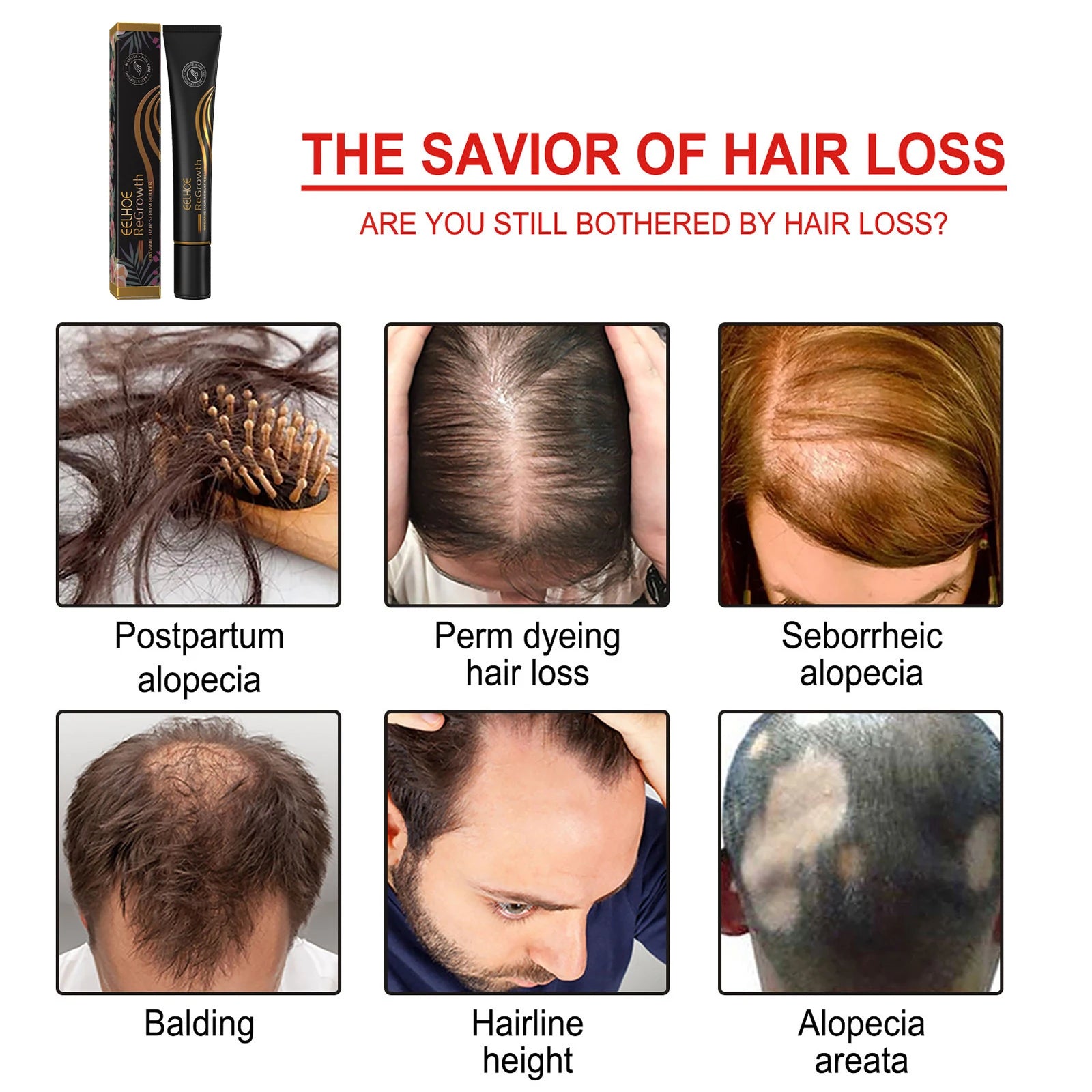 EELHOE Regrowth Hair Serum With Roller Massage Scalp Pure Natural Nourishing Roots Prevent Hair Loss Damage Thickness Hairs Care